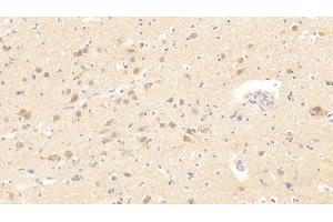 #VALUE! (TMPRSS2 antibody  (AA 284-492))