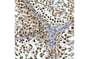 Immunohistochemistry of paraffin-embedded rat testis using NELFCD Rabbit pAb (ABIN1683024, ABIN3019182, ABIN3019183 and ABIN6220747) at dilution of 1:50 (40x lens). (TH1-Like antibody  (AA 355-599))