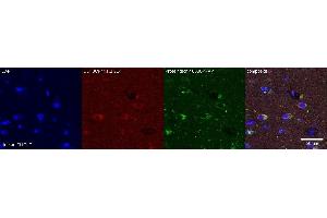 Immunohistochemistry (IHC) image for anti-PDZ and LIM Domain 5 (PDLIM5) antibody (ABIN7456073) (PDLIM5 antibody)