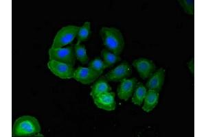 Immunofluorescent analysis of A549 cells using ABIN7162663 at dilution of 1:100 and Alexa Fluor 488-congugated AffiniPure Goat Anti-Rabbit IgG(H+L) (PARD6A antibody  (AA 248-344))