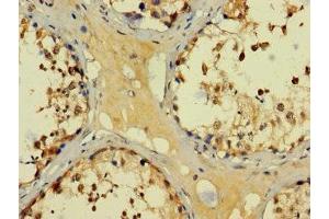 Immunohistochemistry of paraffin-embedded human testis tissue using ABIN7145137 at dilution of 1:100 (BAGE3 antibody  (AA 18-109))