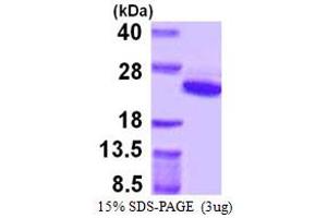 SDS-PAGE (SDS) image for ADP-Ribosylation Factor 5 (ARF5) (AA 1-180) protein (His tag) (ABIN667479) (ARF5 Protein (AA 1-180) (His tag))