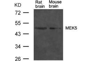 Western blot analysis of extract from rat brain and mouse brain tissue using MEK5 Antibody (MAP2K5 antibody  (AA 311-315))