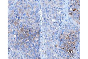 IHC analysis of Desmoglein 2/DSG2 using anti-Desmoglein 2/DSG2 antibody (ABIN7600804). (Desmoglein 2 antibody  (AA 24-1020))