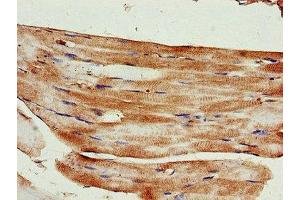 Immunohistochemistry of paraffin-embedded human skeletal muscle tissue using ABIN7157595 at dilution of 1:100 (KIF14 antibody  (AA 261-531))