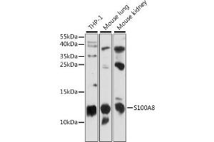 Western blot analysis of extracts of various cell lines, using S100 antibody (ABIN7270129) at 1:1000 dilution. (S100A8 antibody  (AA 1-93))