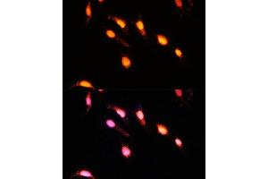 Immunofluorescence analysis of U-2 OS cells using GTF3C4 Polyclonal Antibody  at dilution of 1:100 (40x lens). (GTF3C4 antibody  (AA 583-822))