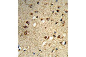 Immunohistochemistry (IHC) image for anti-Nuclear Receptor Coactivator 7 (NCOA7) antibody (ABIN3004220) (NCOA7 antibody)