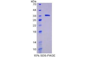 SDS-PAGE (SDS) image for Lymphocyte-Activation Gene 3 (LAG3) (AA 244-487) protein (His tag) (ABIN2125736)