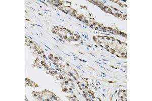 Immunohistochemistry of paraffin-embedded human prostate using TCEB1 antibody (ABIN6131624, ABIN6148930, ABIN6148932 and ABIN6219151) (40x lens).