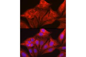 Immunofluorescence analysis of U2OS cells using Galectin 1/LG Rabbit pAb (ABIN6130424, ABIN6143156, ABIN6143157 and ABIN6218649) at dilution of 1:50 (40x lens). (LGALS1/Galectin 1 antibody  (AA 1-135))