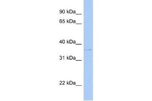 HBXIP antibody used at 1 ug/ml to detect target protein. (HBXIP antibody  (N-Term))