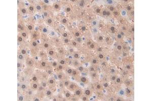 Used in DAB staining on fromalin fixed paraffin- embedded Kidney tissue (ADAM1 antibody  (AA 463-727))