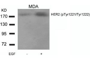 Western blot analysis of extracts from MDA cells untreated or treated with EGF using HER2(Phospho-Tyr1221/Tyr1222) Antibody. (ErbB2/Her2 antibody  (pTyr1221, pTyr1222))