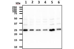 The cell lysates (40ug) were resolved by SDS-PAGE, transferred to PVDF membrane and probed with anti-human REXO2 antibody (1:500). (REXO2 antibody)