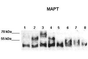 WB Suggested Anti-MAPT Antibody    Positive Control:  Lane 1: 10ug N2A expressed human Tau-C Lane 2: 10ug N2A expressed human Tau-E Lane 3: 10ug N2A expressed human Tau-F Lane 4: 10ug N2A expressed human Tau-B Lane 5: 10ug N2A expressed human Fetal-Tau Lane 6: 10ug N2A expressed human Tau-D Lane 7: 10ug N2A expressed human much Fetal-Tau Lane 8: 10ug N2A lysate   Primary Antibody Dilution :   1:2000  Secondary Antibody :  Donkey anti-rabbit-HRP   Secondry Antibody Dilution :   1:10,000   Submitted by:  Max Holzer, Paul Flechsig Institut of Brain Research, University of Leipzig (MAPT antibody  (Middle Region))