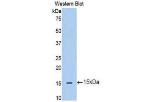 Detection of Recombinant IL13Ra2, Human using Polyclonal Antibody to Interleukin 13 Receptor Alpha 2 (IL13Ra2) (IL13RA2 antibody  (AA 238-334))