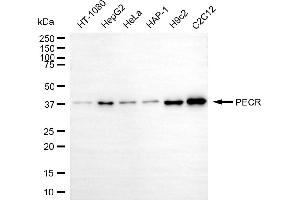 anti-Peroxisomal Trans-2-Enoyl-CoA Reductase (PECR) antibody