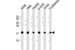 All lanes : Anti-COD1 Antibody (N-Term) at 1:2000 dilution Lane 1: A549 whole cell lysate Lane 2: Hela whole cell lysate Lane 3: HepG2 whole cell lysate Lane 4: U-2OS whole cell lysate Lane 5: Jurkat whole cell lysate Lane 6: human placenta lysate Lysates/proteins at 20 μg per lane. (COMMD1 antibody)