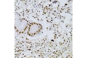 Immunohistochemistry of paraffin-embedded human stomach using SNRNP70 antibody. (SNRNP70 antibody  (AA 150-250))