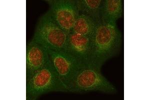 IF analysis of ONECUT1 and Tubulin beta using anti-ONECUT1 antibody (ABIN7599190) and anti-Tubulin beta antibody (ABIN7602744). (ONECUT1 antibody  (AA 1-270))