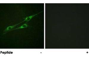Immunofluorescence analysis of NIH/3T3 cells, using IL13RA1 polyclonal antibody .