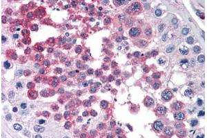 Human Testis: Formalin-Fixed, Paraffin-Embedded (FFPE) (RPS7 antibody  (AA 95-195))