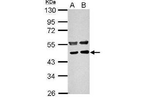 WB Image Sample (30 ug of whole cell lysate) A: NIH-3T3 B: JC 10% SDS PAGE antibody diluted at 1:1000 (PPME1 antibody)