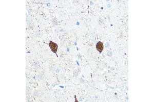 Immunohistochemistry of paraffin-embedded Rat brain using Parvalbumin (Parvalbumin (PVALB)) Rabbit pAb (ABIN3016700, ABIN3016701, ABIN3016702 and ABIN6219820) at dilution of 1:100 (40x lens). (PVALB antibody)