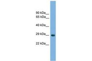 NKX1-2 抗体  (AA 101-150)