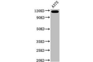 Western Blot Positive WB detected in A375 whole cell lysate All lanes CD146 antibody at 0. (Recombinant MCAM antibody)