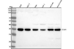 Western blot analysis of STUB1 using anti-STUB1 antibody (ABIN7606405).