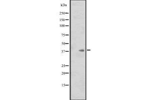 Western blot analysis of ISL1 expression in HL60 whole cell lysate ,The lane on the left is treated with the antigen-specific peptide. (ISL1 antibody  (Internal Region))