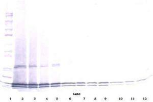 Image no. 2 for anti-Interleukin 17B (IL17B) antibody (ABIN465608) (IL17B antibody)