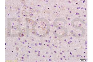 Formalin-fixed and paraffin embedded rat brain tissue labeled with Anti-ARHGAP32 Polyclonal Antibody, Unconjugated (ABIN1386112) at 1:200 followed by conjugation to the secondary antibody and DAB staining (ARHGAP32 antibody  (AA 860-896))