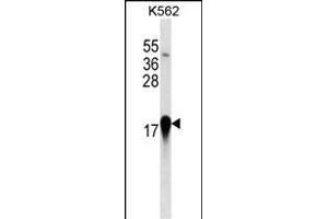 EIF4EBP1 Antibody (ABIN1539800 and ABIN2843786) western blot analysis in K562 cell line lysates (35 μg/lane). (eIF4EBP1 antibody)
