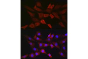 Immunofluorescence analysis of NIH/3T3 cells using PGD Rabbit mAb (ABIN7269315) at dilution of 1:100 (40x lens). (PGD antibody)
