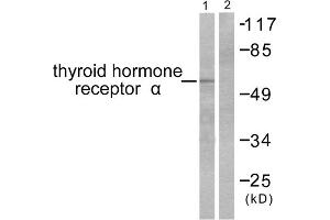 Western blot analysis of extracts from SKOV3 cells, using Thyroid Hormone Receptor alpha antibody (ABIN5976520). (THRA antibody  (N-Term))