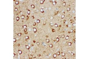 Immunohistochemistry (IHC) image for anti-Inositol 1,4,5-Trisphosphate Receptor, Type 1 (ITPR1) (AA 2411-2758) antibody (ABIN3043862)