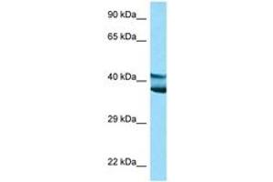 Image no. 1 for anti-Ly1 Antibody Reactive (LYAR) (AA 81-130) antibody (ABIN6748222) (LYAR antibody  (AA 81-130))