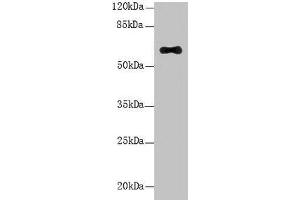 Western Blot All lanes: LRRC31 antibody at 5 μg/mL + Mouse small intestine tissue Secondary Goat polyclonal to rabbit IgG at 1/10000 dilution Predicted band size: 62, 56, 39, 49 kDa Observed band size: 62 kDa (LRRC31 antibody  (AA 1-300))