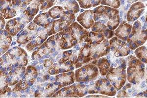ABIN6266814 at 1/100 staining human pancreas tissue sections by IHC-P. (LRAT antibody  (Internal Region))