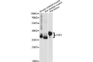 Western blot analysis of extracts of various cell lines, using FBP2 antibody. (FBP2 antibody)