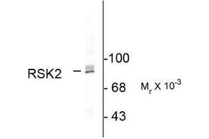 Image no. 1 for anti-Ribosomal Protein S6 Kinase, 90kDa, Polypeptide 3 (RPS6KA3) (C-Term) antibody (ABIN372713) (RPS6KA3 antibody  (C-Term))