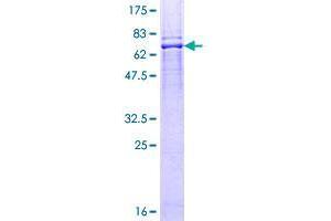 BFAR Protein (AA 1-450) (GST tag)