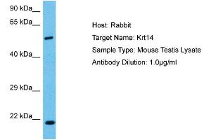 Host:  Mouse  Target Name:  KRT14  Sample Tissue:  Mouse Testis  Antibody Dilution:  1ug/ml (KRT14 antibody  (C-Term))