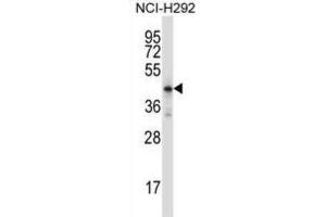 Western Blotting (WB) image for anti-Homeobox D10 (HOXD10) antibody (ABIN2997889)