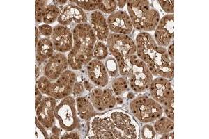 Immunohistochemical staining of human kidney with STRAP polyclonal antibody  shows strong nuclear, cytoplasmic and membranous positivity in cells in tubules at 1:50-1:200 dilution. (STRAP antibody)