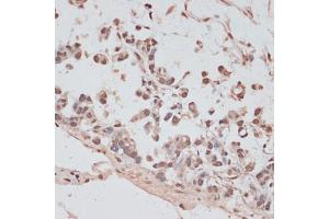 Immunohistochemistry (IHC) image for anti-Pre-mRNA Processing Factor 31 (PRPF31) (AA 1-200) antibody (ABIN6146262)