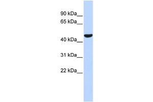 WB Suggested Anti-PTGIS Antibody Titration:  0. (PTGIS antibody  (Middle Region))